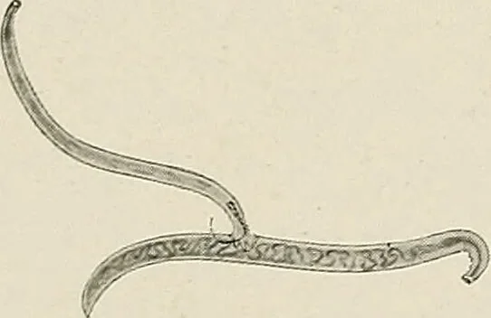 An illustration from Hookworm disease : etiology, pathology, diagnosis, prognosis, prophylaxis, and treatment / by George Dock and Charles C. Bass. Illustrated with forty-nine special engravings and colored plate., 1910, leaf 64