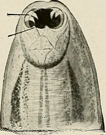 An illustration from Hookworm disease : etiology, pathology, diagnosis, prognosis, prophylaxis, and treatment / by George Dock and Charles C. Bass. Illustrated with forty-nine special engravings and colored plate., 1910, leaf 68