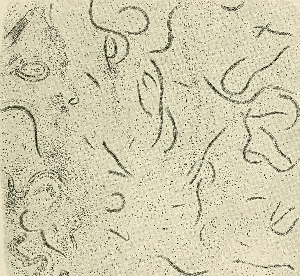 An illustration from Hookworm disease : etiology, pathology, diagnosis, prognosis, prophylaxis, and treatment / by George Dock and Charles C. Bass. Illustrated with forty-nine special engravings and colored plate., 1910, leaf 87
