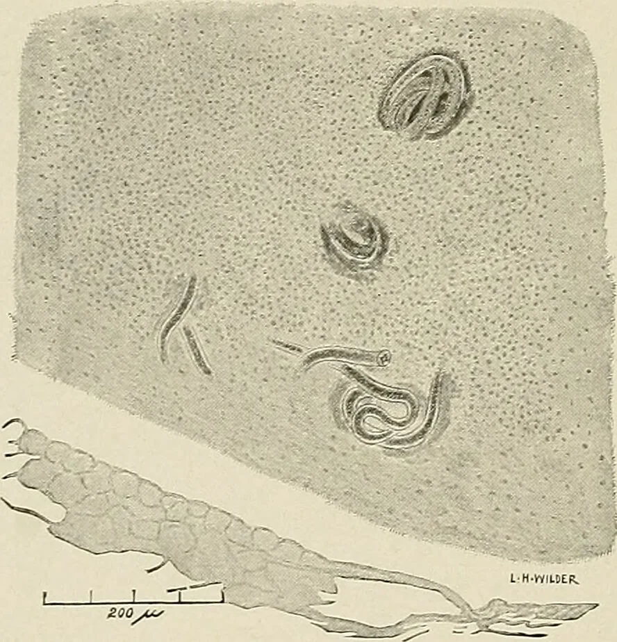 An illustration from Hookworm disease : etiology, pathology, diagnosis, prognosis, prophylaxis, and treatment / by George Dock and Charles C. Bass. Illustrated with forty-nine special engravings and colored plate., 1910, leaf 88