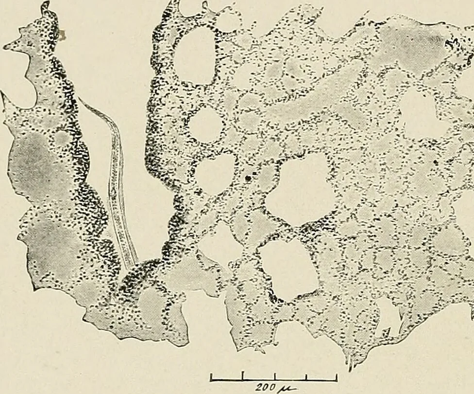 An illustration from Hookworm disease : etiology, pathology, diagnosis, prognosis, prophylaxis, and treatment / by George Dock and Charles C. Bass. Illustrated with forty-nine special engravings and colored plate., 1910, leaf 90