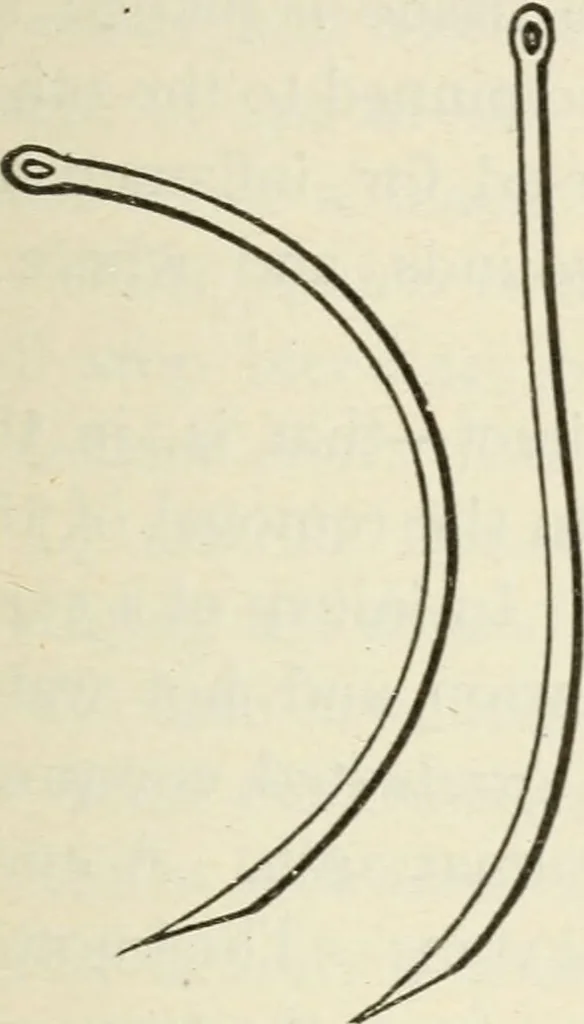 An illustration from A manual of modern surgery, general and operative : With 188 illus. in the text and 13 full-page plates in colors and tints, aggregating 276 separate figures., 1894, leaf 261