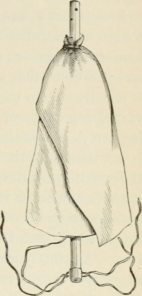 An illustration from A manual of modern surgery, general and operative : With 188 illus. in the text and 13 full-page plates in colors and tints, aggregating 276 separate figures., 1894, leaf 271