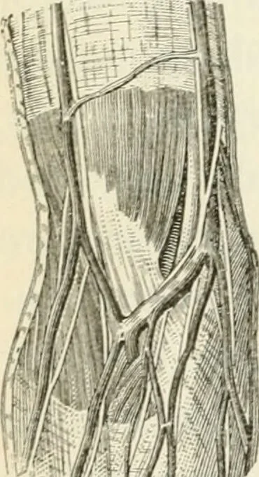 An illustration from A manual of modern surgery, general and operative : With 188 illus. in the text and 13 full-page plates in colors and tints, aggregating 276 separate figures., 1894, leaf 276