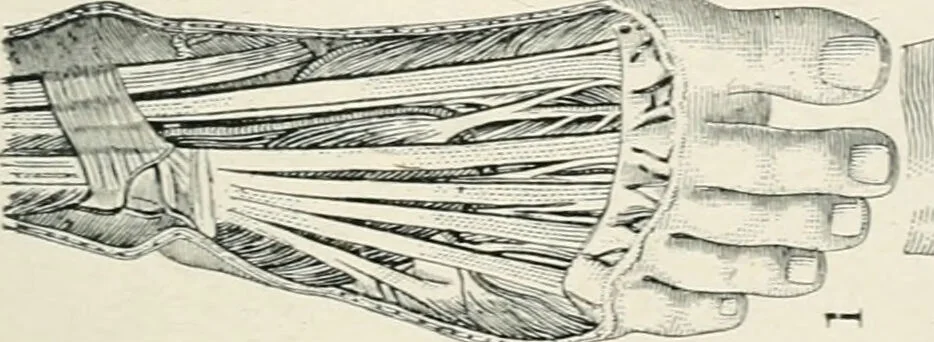 An illustration from A manual of modern surgery, general and operative : With 188 illus. in the text and 13 full-page plates in colors and tints, aggregating 276 separate figures., 1894, leaf 305