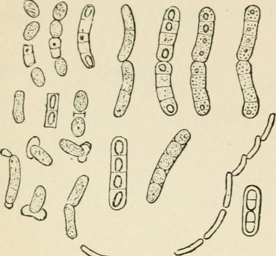 An illustration from A manual of modern surgery, general and operative : With 188 illus. in the text and 13 full-page plates in colors and tints, aggregating 276 separate figures., 1894, leaf 34
