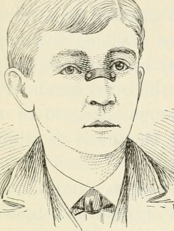 An illustration from A manual of modern surgery, general and operative : With 188 illus. in the text and 13 full-page plates in colors and tints, aggregating 276 separate figures., 1894, leaf 352