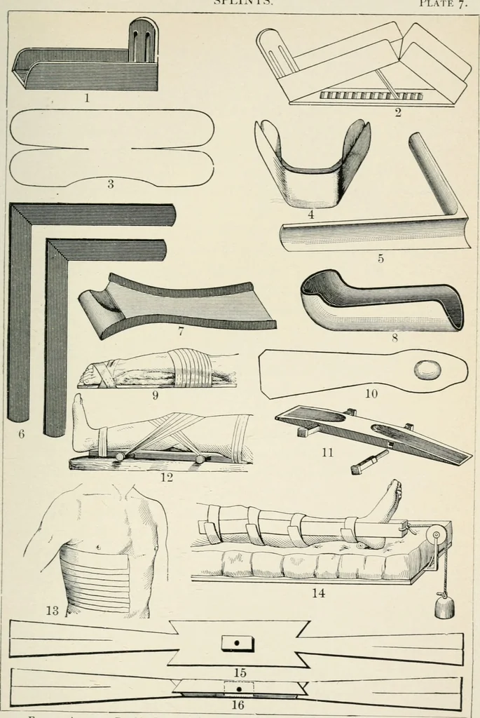 An illustration from A manual of modern surgery, general and operative : With 188 illus. in the text and 13 full-page plates in colors and tints, aggregating 276 separate figures., 1894, leaf 355