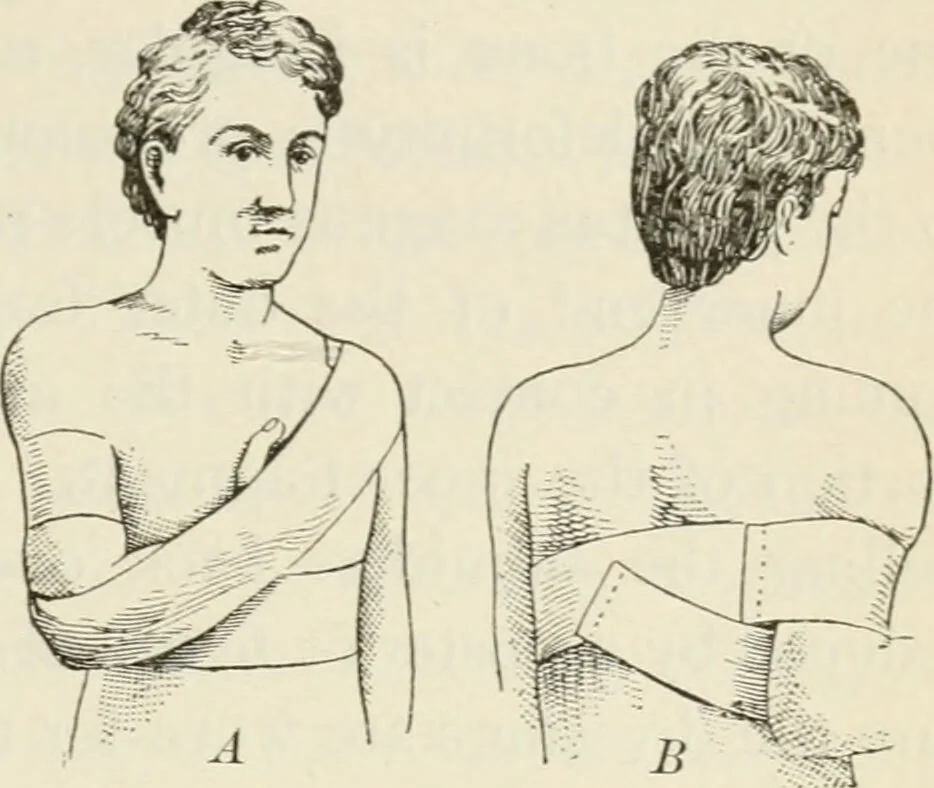 An illustration from A manual of modern surgery, general and operative : With 188 illus. in the text and 13 full-page plates in colors and tints, aggregating 276 separate figures., 1894, leaf 375