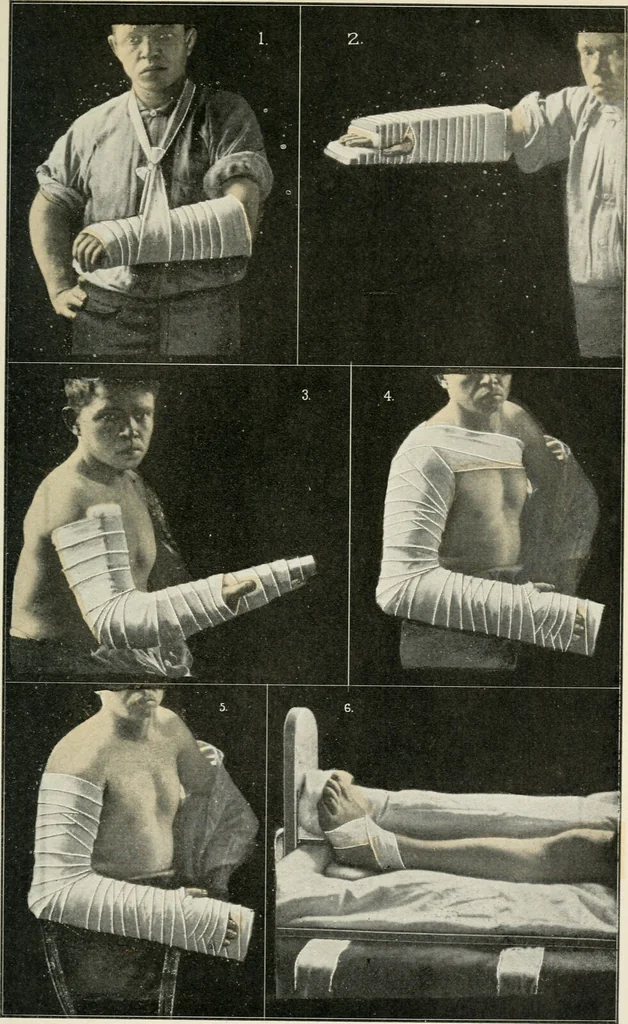 An illustration from A manual of modern surgery, general and operative : With 188 illus. in the text and 13 full-page plates in colors and tints, aggregating 276 separate figures., 1894, leaf 381