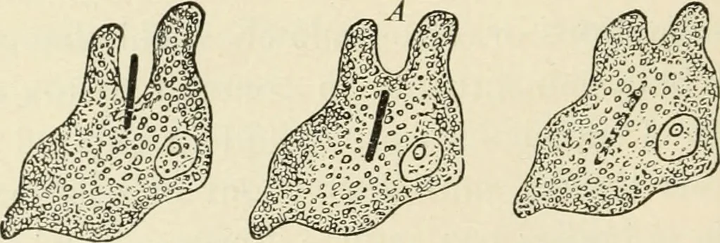 An illustration from A manual of modern surgery, general and operative : With 188 illus. in the text and 13 full-page plates in colors and tints, aggregating 276 separate figures., 1894, leaf 40