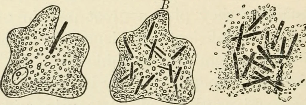 An illustration from A manual of modern surgery, general and operative : With 188 illus. in the text and 13 full-page plates in colors and tints, aggregating 276 separate figures., 1894, leaf 40