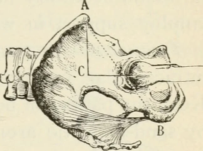 An illustration from A manual of modern surgery, general and operative : With 188 illus. in the text and 13 full-page plates in colors and tints, aggregating 276 separate figures., 1894, leaf 401