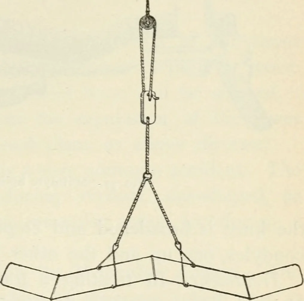 An illustration from A manual of modern surgery, general and operative : With 188 illus. in the text and 13 full-page plates in colors and tints, aggregating 276 separate figures., 1894, leaf 409