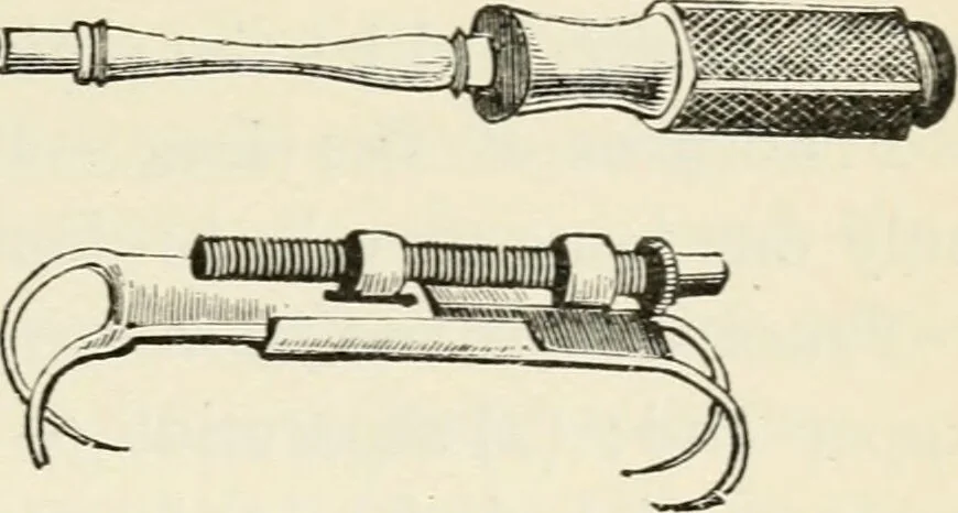 An illustration from A manual of modern surgery, general and operative : With 188 illus. in the text and 13 full-page plates in colors and tints, aggregating 276 separate figures., 1894, leaf 413