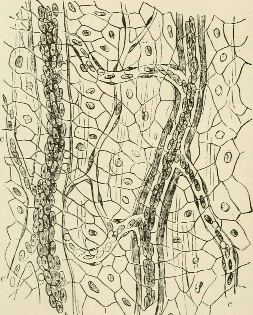 An illustration from A manual of modern surgery, general and operative : With 188 illus. in the text and 13 full-page plates in colors and tints, aggregating 276 separate figures., 1894, leaf 46