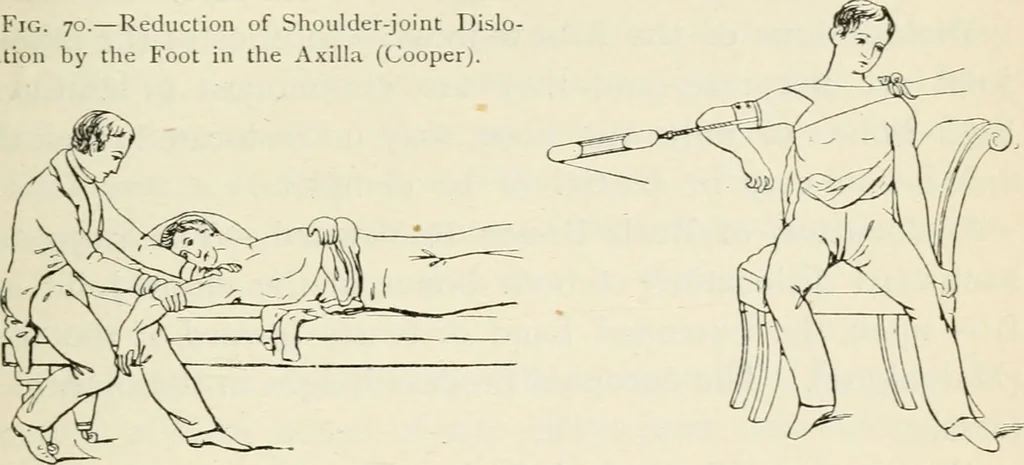 An illustration from A manual of modern surgery, general and operative : With 188 illus. in the text and 13 full-page plates in colors and tints, aggregating 276 separate figures., 1894, leaf 475
