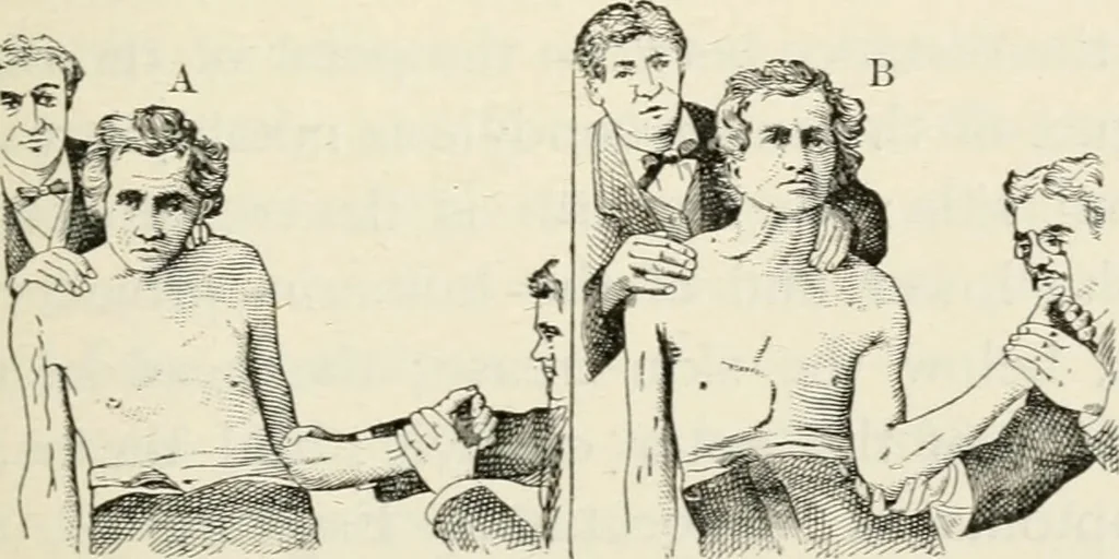 An illustration from A manual of modern surgery, general and operative : With 188 illus. in the text and 13 full-page plates in colors and tints, aggregating 276 separate figures., 1894, leaf 475