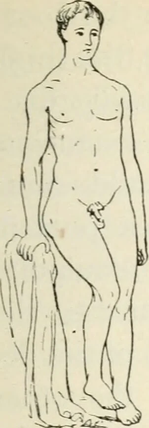 An illustration from A manual of modern surgery, general and operative : With 188 illus. in the text and 13 full-page plates in colors and tints, aggregating 276 separate figures., 1894, leaf 487
