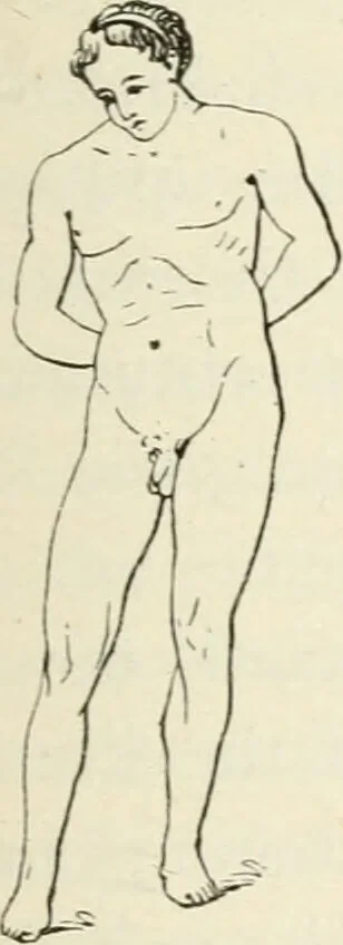An illustration from A manual of modern surgery, general and operative : With 188 illus. in the text and 13 full-page plates in colors and tints, aggregating 276 separate figures., 1894, leaf 487