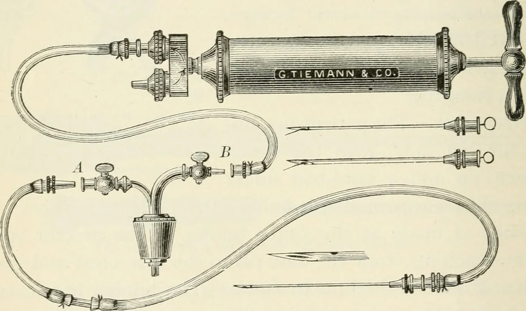 An illustration from A manual of modern surgery, general and operative : With 188 illus. in the text and 13 full-page plates in colors and tints, aggregating 276 separate figures., 1894, leaf 508