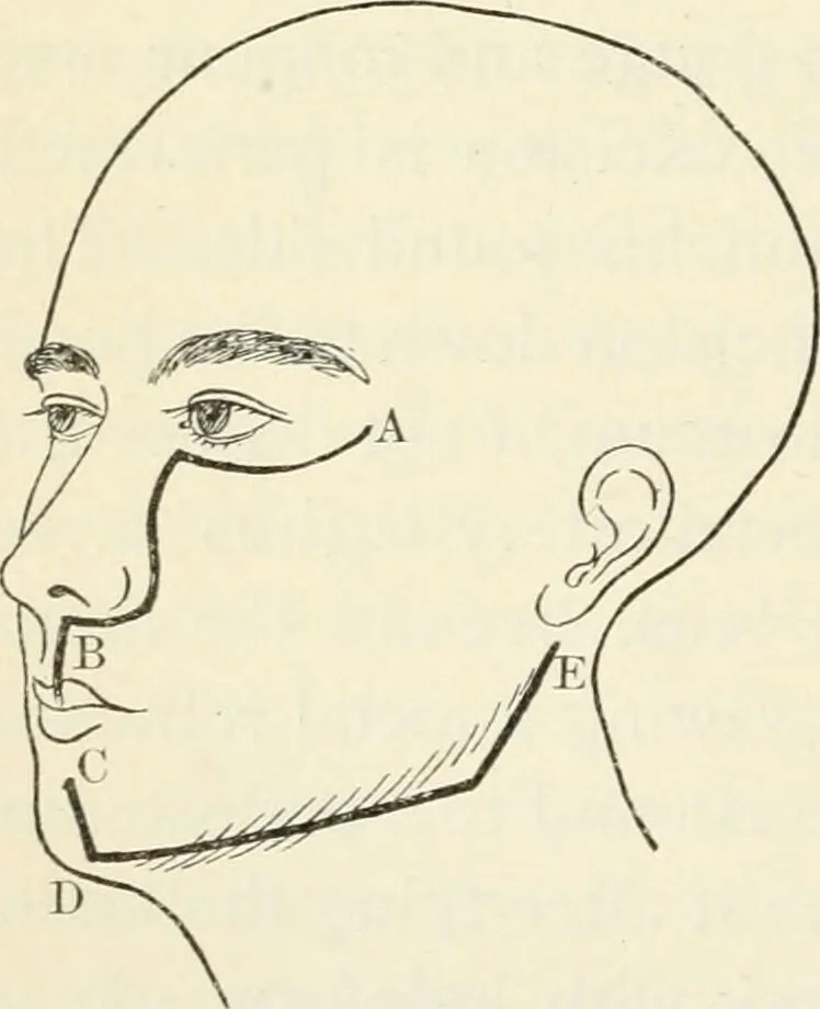 An illustration from A manual of modern surgery, general and operative : With 188 illus. in the text and 13 full-page plates in colors and tints, aggregating 276 separate figures., 1894, leaf 528
