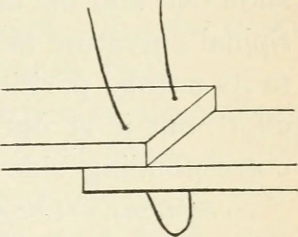 An illustration from A manual of modern surgery, general and operative : With 188 illus. in the text and 13 full-page plates in colors and tints, aggregating 276 separate figures., 1894, leaf 545