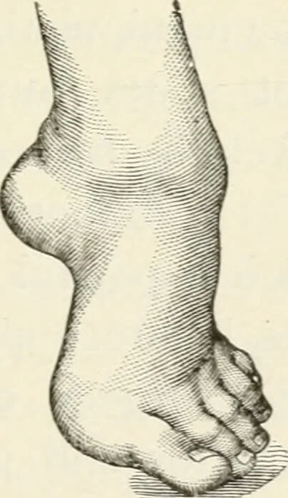An illustration from A manual of modern surgery, general and operative : With 188 illus. in the text and 13 full-page plates in colors and tints, aggregating 276 separate figures., 1894, leaf 549