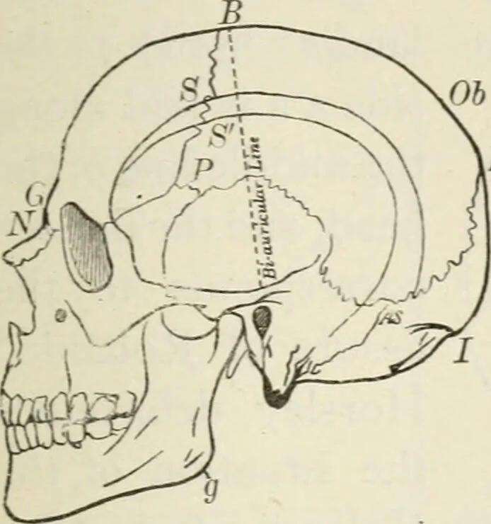 An illustration from A manual of modern surgery, general and operative : With 188 illus. in the text and 13 full-page plates in colors and tints, aggregating 276 separate figures., 1894, leaf 559