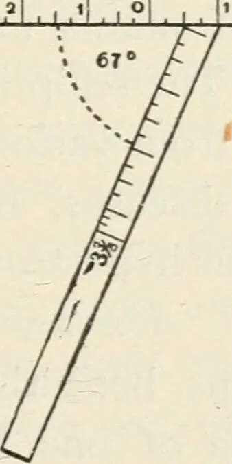 An illustration from A manual of modern surgery, general and operative : With 188 illus. in the text and 13 full-page plates in colors and tints, aggregating 276 separate figures., 1894, leaf 561