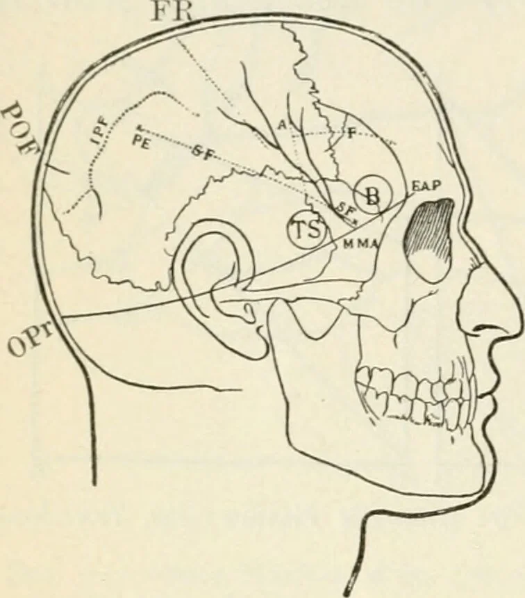 An illustration from A manual of modern surgery, general and operative : With 188 illus. in the text and 13 full-page plates in colors and tints, aggregating 276 separate figures., 1894, leaf 562