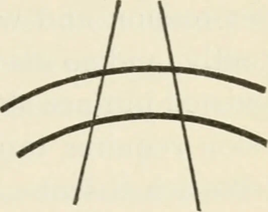 An illustration from A manual of modern surgery, general and operative : With 188 illus. in the text and 13 full-page plates in colors and tints, aggregating 276 separate figures., 1894, leaf 573