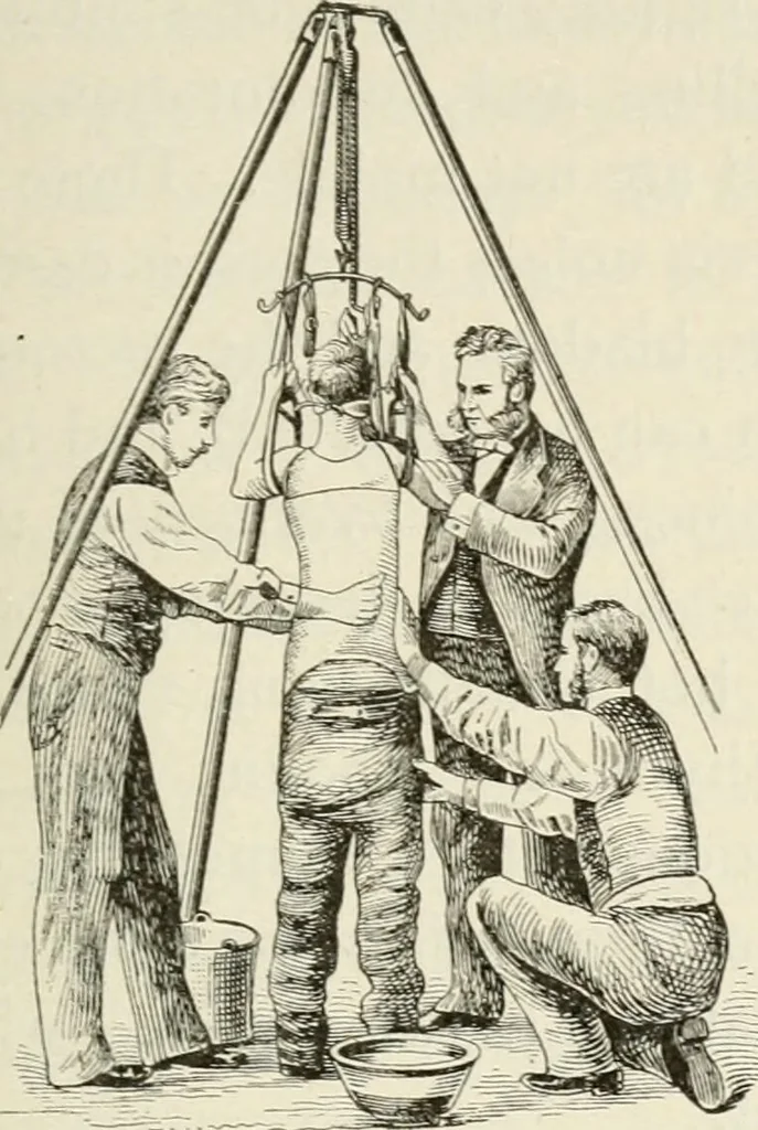 An illustration from A manual of modern surgery, general and operative : With 188 illus. in the text and 13 full-page plates in colors and tints, aggregating 276 separate figures., 1894, leaf 603