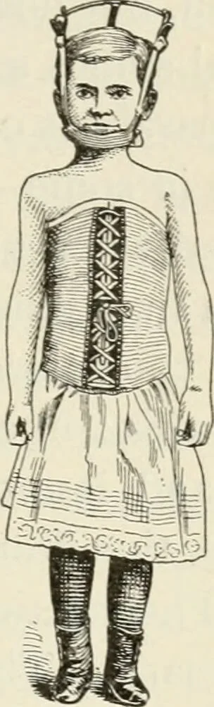 An illustration from A manual of modern surgery, general and operative : With 188 illus. in the text and 13 full-page plates in colors and tints, aggregating 276 separate figures., 1894, leaf 603
