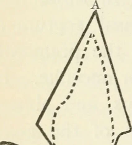 An illustration from A manual of modern surgery, general and operative : With 188 illus. in the text and 13 full-page plates in colors and tints, aggregating 276 separate figures., 1894, leaf 626
