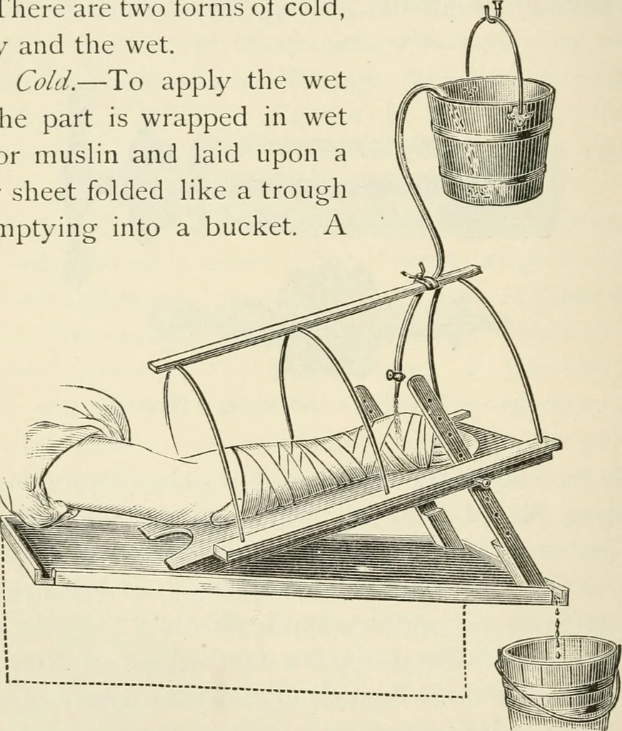 An illustration from A manual of modern surgery, general and operative : With 188 illus. in the text and 13 full-page plates in colors and tints, aggregating 276 separate figures., 1894, leaf 64