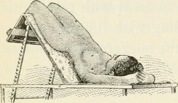 An illustration from A manual of modern surgery, general and operative : With 188 illus. in the text and 13 full-page plates in colors and tints, aggregating 276 separate figures., 1894, leaf 658