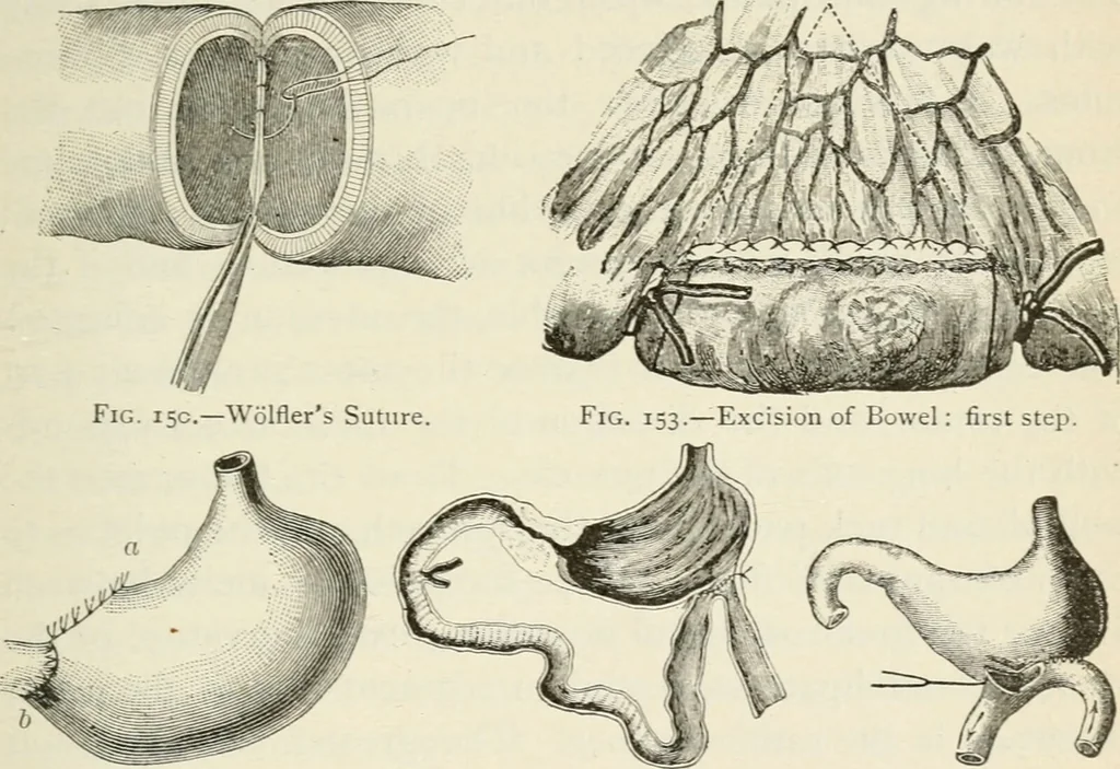 An illustration from A manual of modern surgery, general and operative : With 188 illus. in the text and 13 full-page plates in colors and tints, aggregating 276 separate figures., 1894, leaf 661
