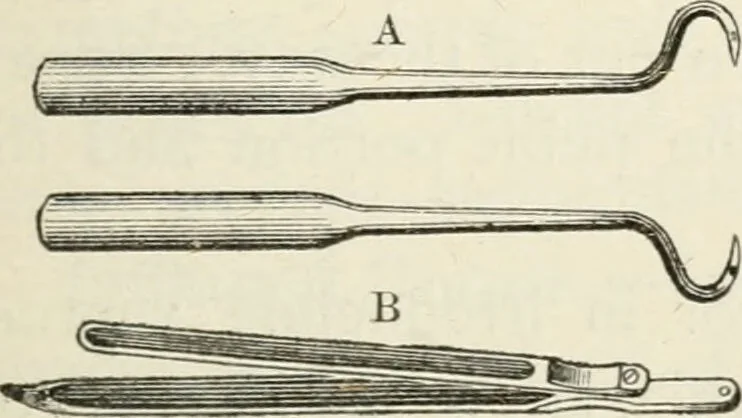 An illustration from A manual of modern surgery, general and operative : With 188 illus. in the text and 13 full-page plates in colors and tints, aggregating 276 separate figures., 1894, leaf 673