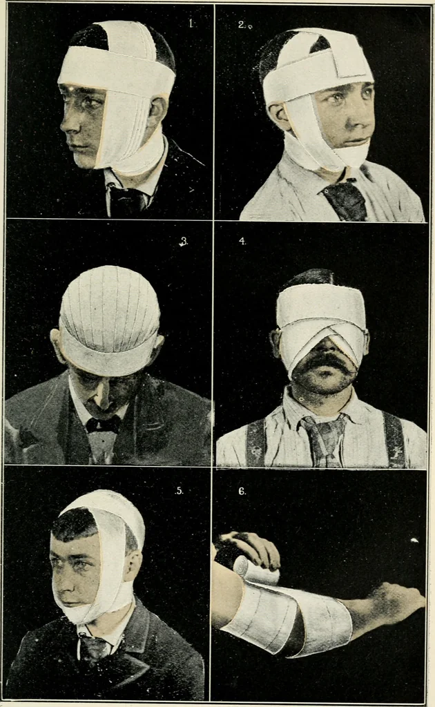 An illustration from A manual of modern surgery, general and operative : With 188 illus. in the text and 13 full-page plates in colors and tints, aggregating 276 separate figures., 1894, leaf 715