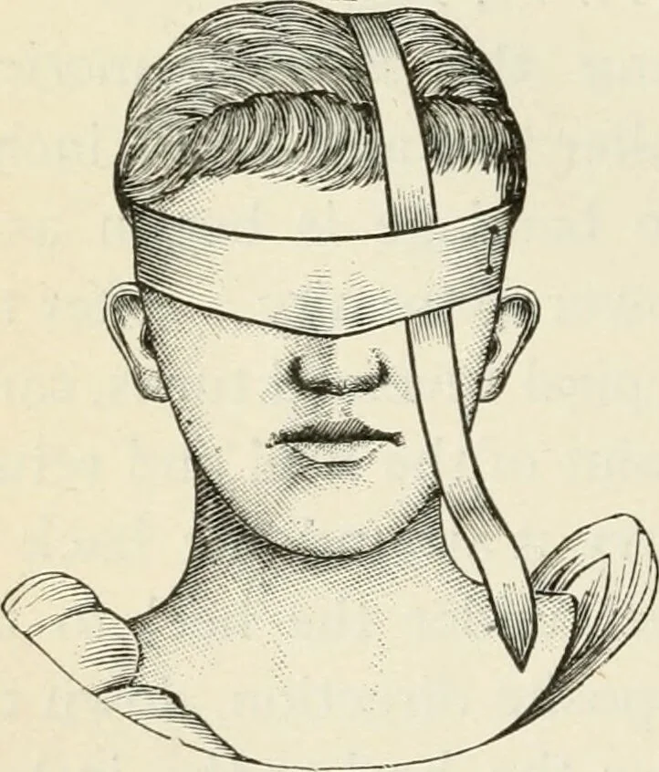 An illustration from A manual of modern surgery, general and operative : With 188 illus. in the text and 13 full-page plates in colors and tints, aggregating 276 separate figures., 1894, leaf 718