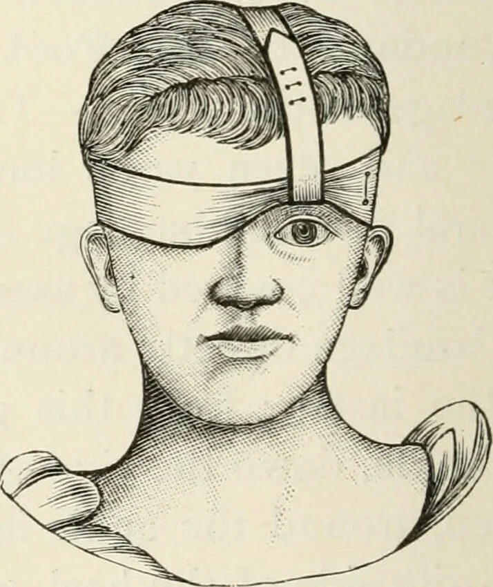 An illustration from A manual of modern surgery, general and operative : With 188 illus. in the text and 13 full-page plates in colors and tints, aggregating 276 separate figures., 1894, leaf 718