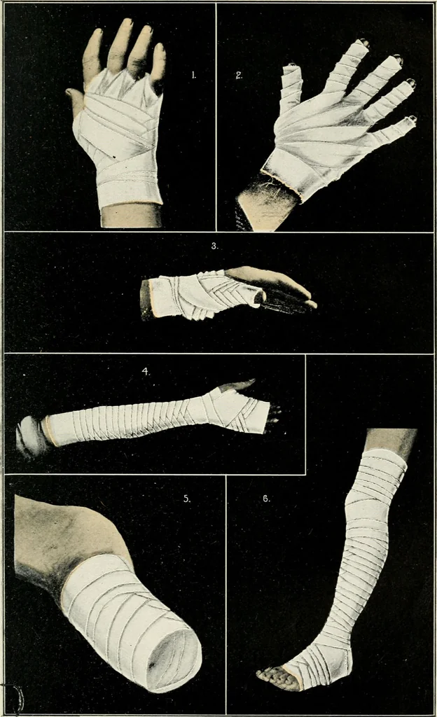 An illustration from A manual of modern surgery, general and operative : With 188 illus. in the text and 13 full-page plates in colors and tints, aggregating 276 separate figures., 1894, leaf 719