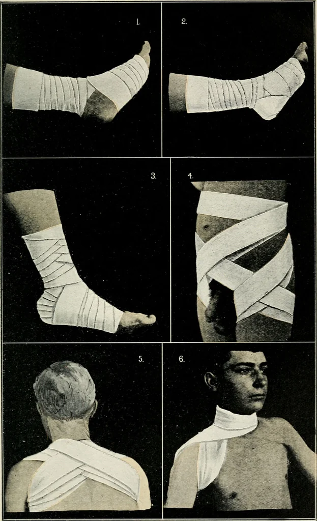 An illustration from A manual of modern surgery, general and operative : With 188 illus. in the text and 13 full-page plates in colors and tints, aggregating 276 separate figures., 1894, leaf 723