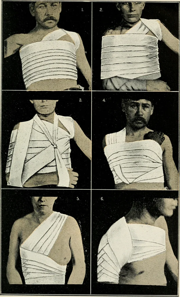 An illustration from A manual of modern surgery, general and operative : With 188 illus. in the text and 13 full-page plates in colors and tints, aggregating 276 separate figures., 1894, leaf 727