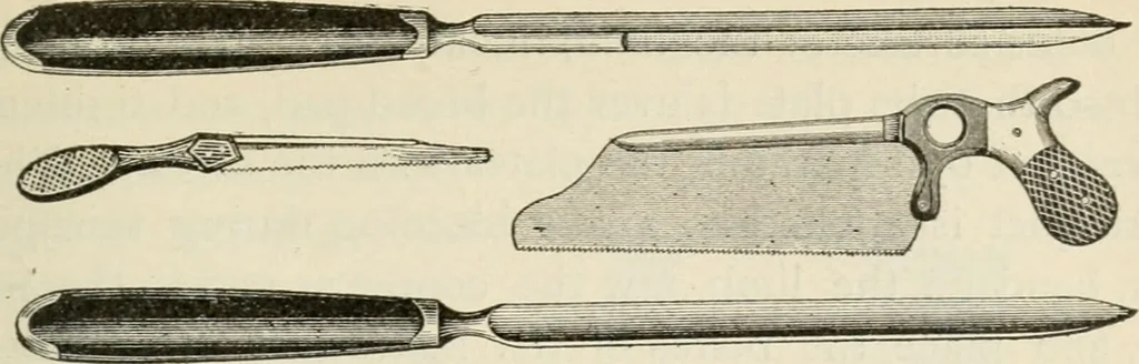 An illustration from A manual of modern surgery, general and operative : With 188 illus. in the text and 13 full-page plates in colors and tints, aggregating 276 separate figures., 1894, leaf 801
