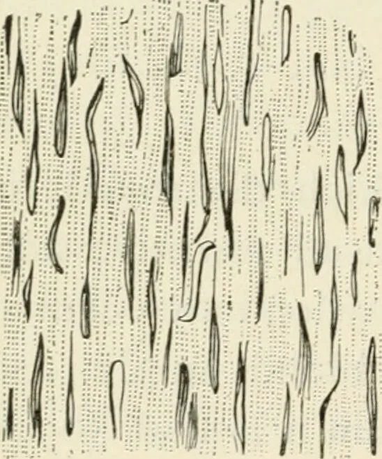An illustration from A manual of modern surgery, general and operative : With 188 illus. in the text and 13 full-page plates in colors and tints, aggregating 276 separate figures., 1894, leaf 86