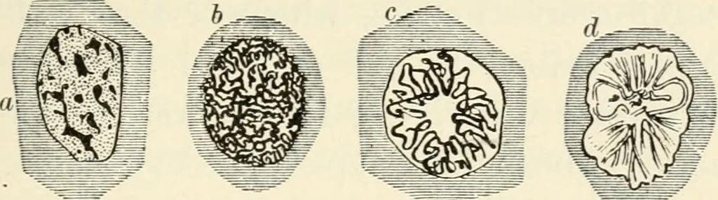 An illustration from A manual of modern surgery, general and operative : With 188 illus. in the text and 13 full-page plates in colors and tints, aggregating 276 separate figures., 1894, leaf 89