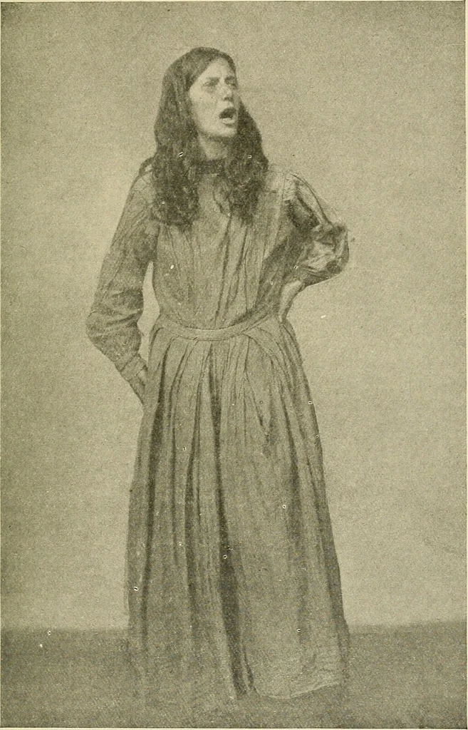 An illustration from Mental diseases : A text-book of psychiatry for medical students and practitioners / by R.H. Cole, ... With fifty-two illustrations and plates., 1913, leaf 149