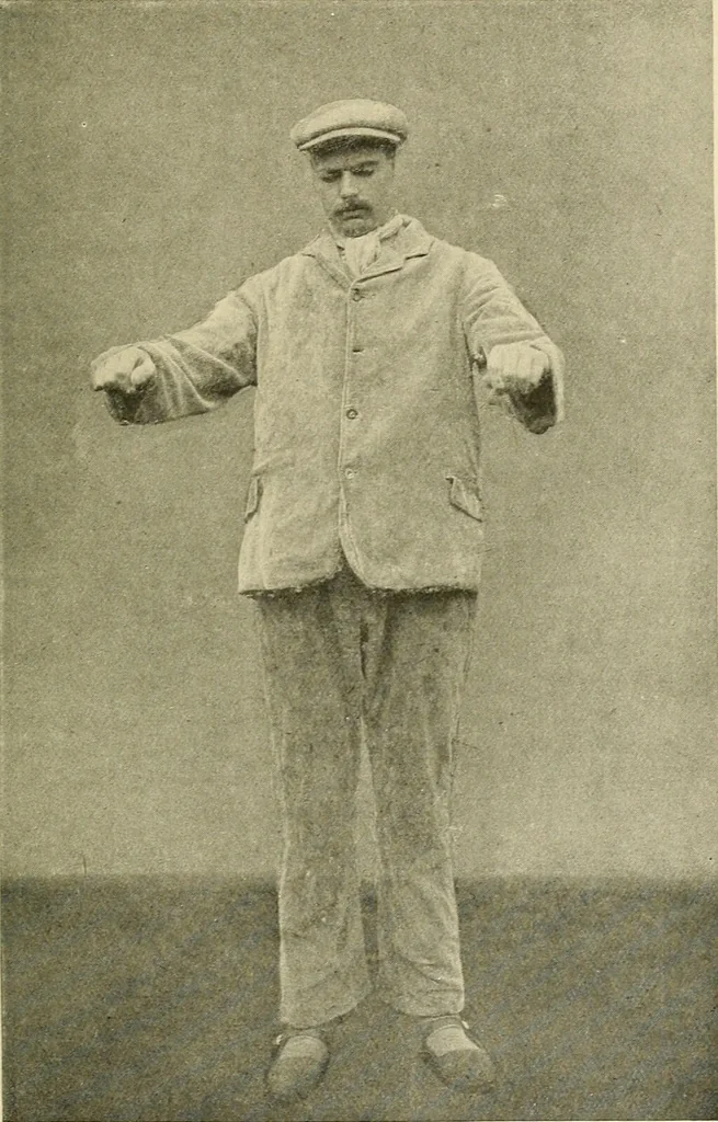 An illustration from Mental diseases : A text-book of psychiatry for medical students and practitioners / by R.H. Cole, ... With fifty-two illustrations and plates., 1913, leaf 181